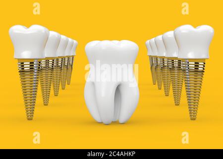 Dente premolare sano tra file di impianti dentali su sfondo giallo. Rendering 3d Foto Stock