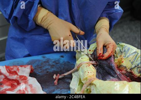 Rapporto presso l'ospedale di maternità dell'ospedale di Abbeville. Parto cesareo di una donna incinta con gemelli. Intervento programmato. Presenza in Foto Stock