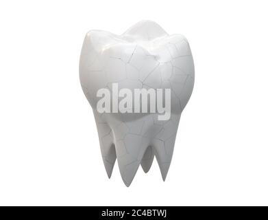 Dente molare incrinato isolato su fondo bianco. illustrazione 3d Foto Stock