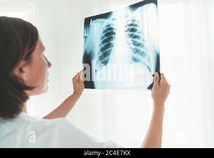 Medico femminile che controlla la pellicola radiogena del torace del paziente esegue scansioni polmonari presso il reparto di radiologia in ospedale. Disturbi polmonari o Covid-19 scansione polmoni xray detectio Foto Stock