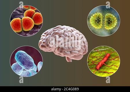 Cause della meningite batterica, illustrazione del computer. I principali agenti causativi della meningite batterica sono i batteri Neisseria meningitidis, Streptococcus pneumoniae, Haemophilus influenzae e Listeria monocytogenes. Foto Stock