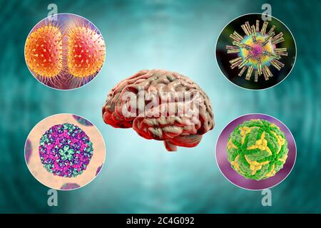 Infezioni cerebrali. Illustrazione al computer di microrganismi che causano encefalite e meningite. Foto Stock