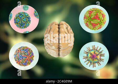 Infezioni cerebrali. Illustrazione al computer di microrganismi che causano encefalite e meningite. Foto Stock