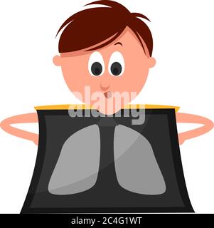 Raggi X di polmoni, illustrazione, vettore su sfondo bianco Illustrazione Vettoriale