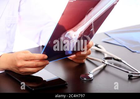 Donna Dottore guardando la radiografia a raggi X nella stanza del paziente, medico radiologia guardando la pellicola a raggi X del paziente in ospedale. Foto Stock