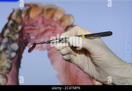 Dresda, Germania. 24 Giugno 2020. ILLUSTRAZIONE - UN igienista dentale tiene uno specchio della bocca nelle sue mani in una pratica dentale. Sullo sfondo, è possibile visualizzare su uno schermo un modello di ganascia virtuale per la diagnosi e la terapia successiva. (Scena posta) (a dpa 'con l'alta tecnologia da crisi di Corona: Dresden dentista si basa sul digitale') credito: Robert Michael/dpa-Zentralbild/dpa/Alamy Live News Foto Stock