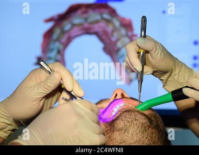 Dresda, Germania. 24 Giugno 2020. ILLUSTRAZIONE - il dentista Conrad Kühnöl (l) e un igienista dentale esaminano un paziente con un microscopio fluorescente nella pratica dentale. (Posed scene) Credit: Roberto Michael/dpa-Zentralbild/ZB/dpa/Alamy Live News Foto Stock