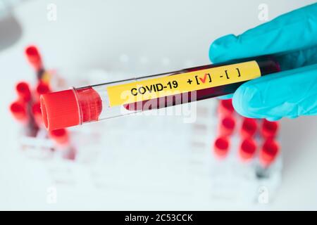 La mano di laboratoriana mostra un risultato positivo della provetta COVID-19 nel laboratorio del coronavirus. Foto Stock