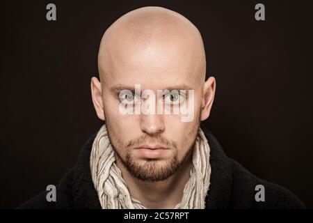 calvizie skinhead rasata testa uomo arrabbiato razzista Foto Stock