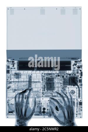 Digitazione delle mani su un computer portatile aperto, raggi X. Foto Stock