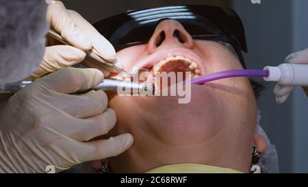 Donna anziana che ottiene l'impianto dentale Foto Stock