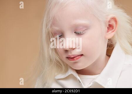 ritratto di bambina caucasica con sindrome da albinismo. sguardo del bambino verso il basso. deviazioni anomale. aspetto insolito. anomalia della pelle Foto Stock