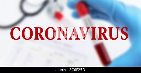 Panorama di Coronavirus test. Il medico ha a portata di mano un guanto medico che tiene la provetta con sangue positivo Coronavirus sopra la scrivania del laboratorio. Foto Stock