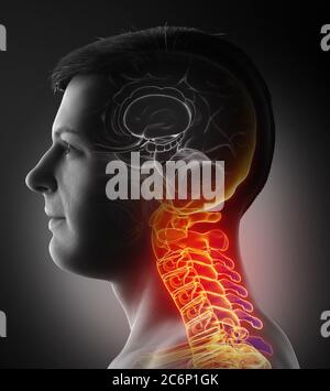 rappresentazione 3d, con precisione medica, di un maschio che ha un collo doloroso Foto Stock