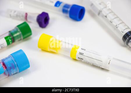 Analisi del sangue provette vuote campioni su sfondo bianco, riprese in studio. Provette colorate, nome, data e test. Foto Stock
