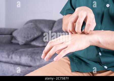 Giovane uomo che gratta la mano mentre si siede sul divano a casa. Concetto di salute medica o vita quotidiana. Foto Stock