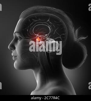 Rappresentazione 3d illustrazione medica di una femmina anatomia cerebrale GHIANDOLA PITUITARIA - sezione trasversale Foto Stock