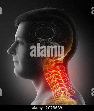 rappresentazione 3d, con precisione medica, di un maschio che ha un collo doloroso Foto Stock