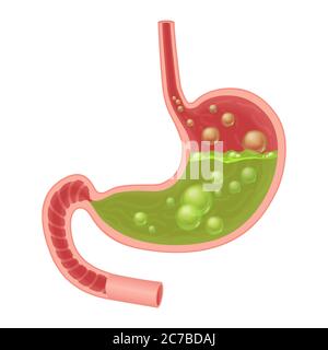 Illustrazione medica realistica di nausea stomaco isolato. Liquido verde all'interno dello stomaco Illustrazione Vettoriale