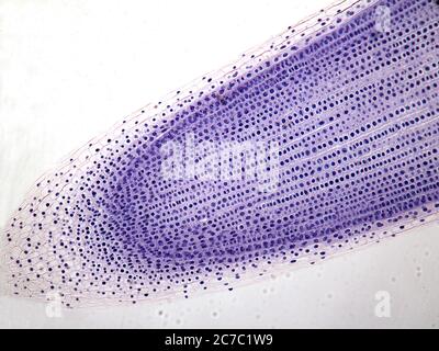Microfotografia della mitosi di radice di una cipolla. Foto Stock