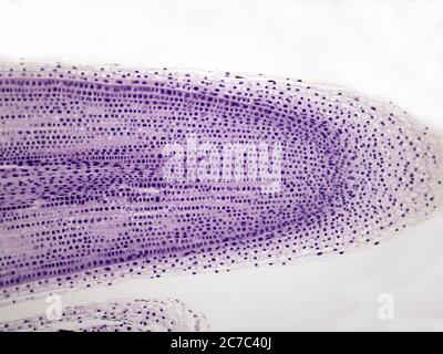 Microfotografia della radice di cipolla. Foto Stock
