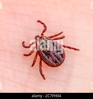 Encefalite Tick Insect strisciando sulla pelle. Virus encefalite o malattia di Lyme borreliosi Dermacentor infettivo Tick Arachnid parassita Macro. Foto Stock