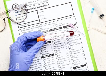 Mano del medico con campione di sangue in provetta e modulo di analisi di laboratorio, vista dall'alto. Concetto di malattia tiroidea Foto Stock