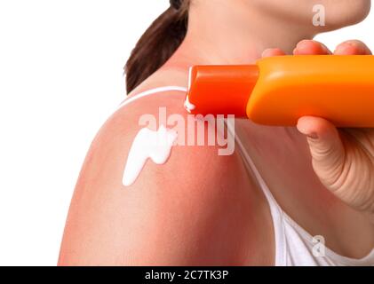 Donna con pelle scottata rossa che applica crema su sfondo bianco, closeup Foto Stock