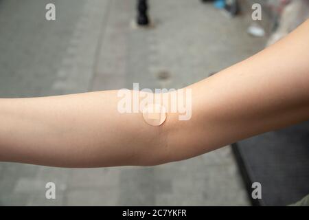 primo piano del supporto elastico sul braccio Foto Stock