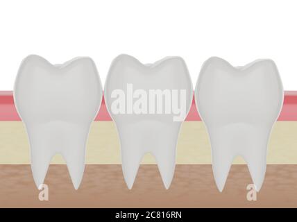 tre denti molari puliti nella gomma, rendering 3d Foto Stock