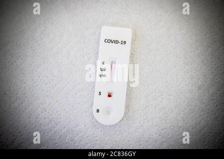 Parigi, Francia. 20 luglio 2020. Una cassetta per test sierologico rapido con anticorpi COVID-19 viene raffigurata in una farmacia a Parigi, Francia, il 20 luglio 2020. Per accelerare lo screening del COVID-19, i farmacisti francesi sono stati autorizzati, dal luglio 11 e fino all'ottobre 30, Effettuare un test sierologico rapido anticorpale che consente di testare in circa dieci minuti una semplice goccia di sangue prelevato dalla punta del dito per la possibile presenza di anticorpi contro COVID-19. Credit: Aurelien Morissard/Xinhua/Alamy Live News Foto Stock