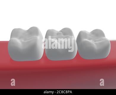 tre denti molari nella gomma, riempimento polimerico di un dente al centro, resa 3d Foto Stock