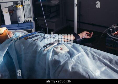 Chirurgo che esegue chirurgia estetica sul naso in sala operatoria dell'ospedale. Chirurgo in maschera indossare loupes chirurgico durante la procedura medica. Naso aumento Foto Stock