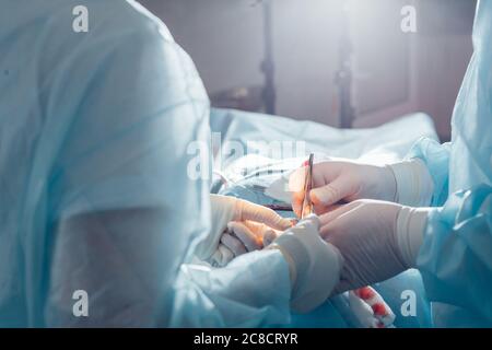 Primo piano del chirurgo e del suo assistente che esegue la chirurgia estetica in sala operatoria dell'ospedale. Medico che tiene gli strumenti chirurgici durante il medico Foto Stock