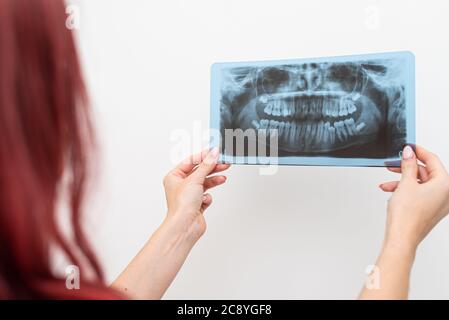 Il medico ortodontista analizza l'ortopantomogramma delle mascelle del paziente per diagnosticare Foto Stock