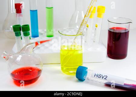 Campione di provetta per analisi del sangue HSV, ricerca e diagnosi di laboratorio, elementi medici, sfondo bianco e riprese in studio. Foto Stock