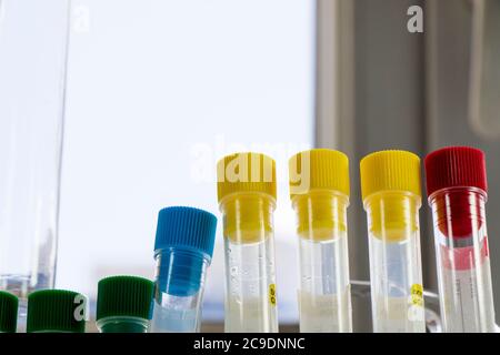 Campioni di provette per analisi del sangue da laboratorio, diagnosi di ricerca, strumenti e oggetti nel tavolo sterile Studio Shoot. Foto Stock
