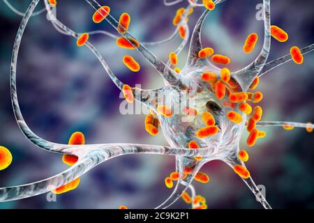 Encefalite batterica. Illustrazione concettuale del computer che mostra i batteri che infettano le cellule cerebrali. Foto Stock