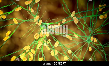 Encefalite batterica. Illustrazione concettuale del computer che mostra i batteri che infettano le cellule cerebrali. Foto Stock