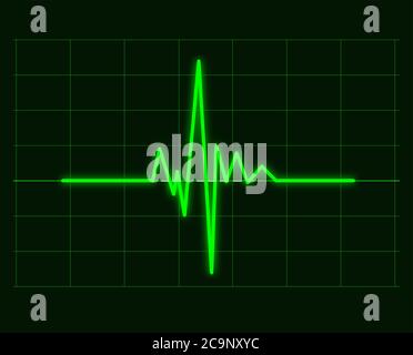 Illustrazione vettoriale delle forme d'onda cardiache verdi del cardiogramma cardiaco, dell'ecg o dell'elettrocardiogramma Foto Stock