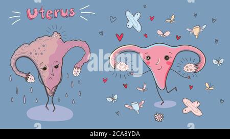 Cartoon vettore illustrazione di utero sano e malato. Divertente illustrazione educativa. Illustrazione Vettoriale