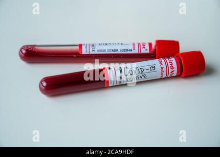 Messa a fuoco morbida di una fiala con un campione di sangue positivo di COVID-19 su un tavolo bianco Foto Stock