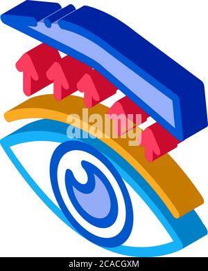 rappresentazione vettoriale dell'icona isometrica del trattamento chirurgico alle palpebre Illustrazione Vettoriale