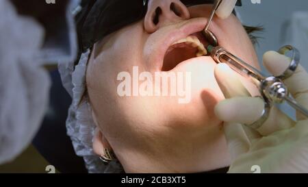 Donna anziana che ottiene l'impianto dentale Foto Stock