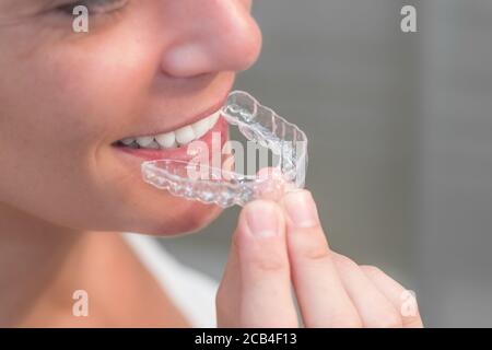 Donna che indossa tutori invisibili. Apparecchio ortodontico mobile per la correzione dentale. Foto Stock