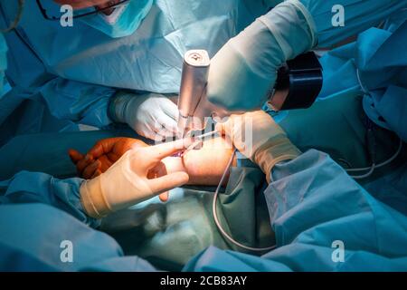 due medici operano su una frattura del polso in un operating teatro Foto Stock