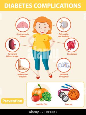 Infografica medica delle complicazioni del diabete e illustrazione delle prevenzioni Illustrazione Vettoriale