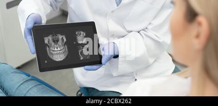 Consulenza dentale in clinica. Dentista che mostra i raggi X dei denti sullo schermo del tablet digitale. Tecnologia di tomografia 3D. Foto Stock
