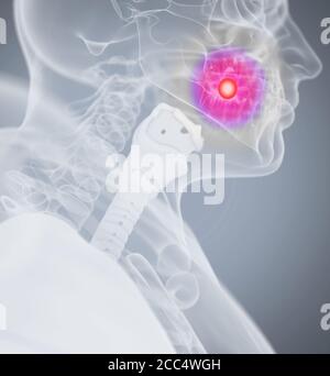 Dolore ai denti. Immagine a raggi X della testa dell'anatomia umana. Illustrazione 3D. Foto Stock