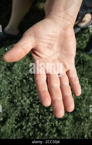 Calluss sulle mani, primo piano delle mani maschili. Foto di alta qualità Foto Stock